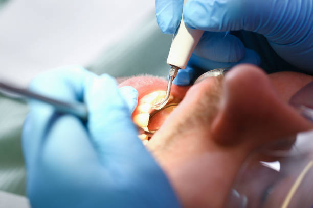 Best Emergency Dental Services for Seniors in Acushnet Center, MA